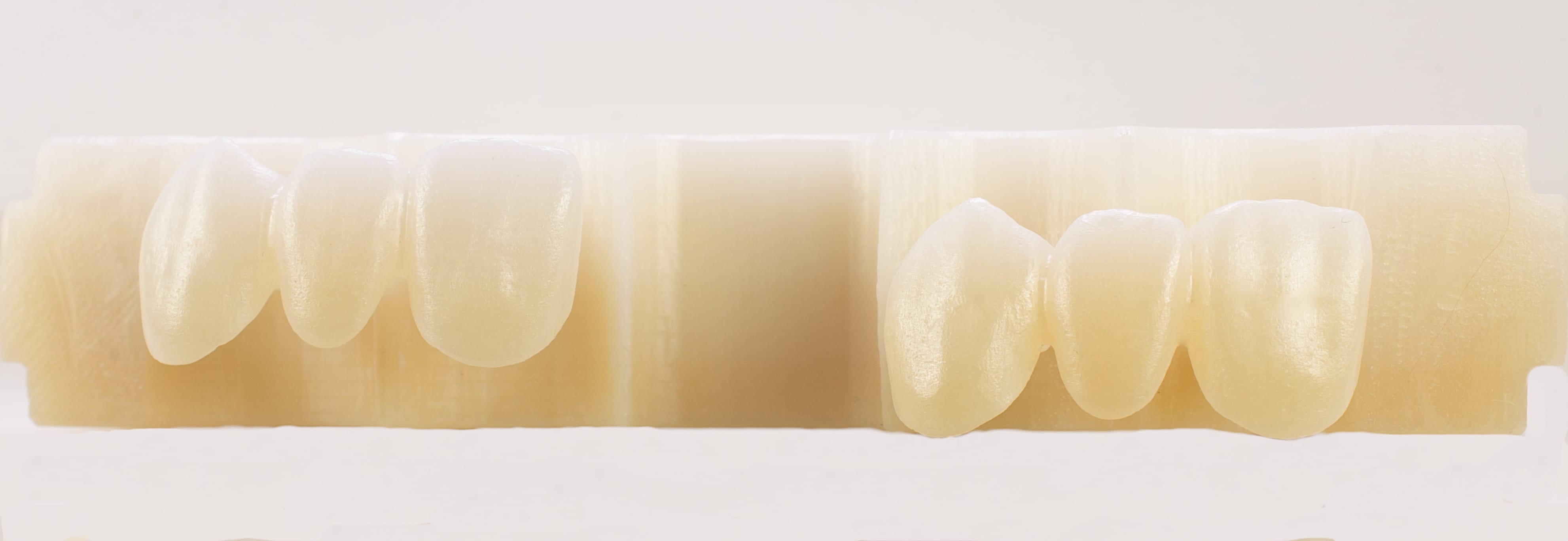 Unveiling the Future: Advanced Innovations in Zirconia Dental Prosthetics Production